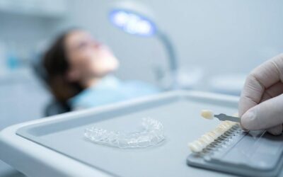 Smileffect tandblegning: Før/efter, holdbarhed og vedligehold