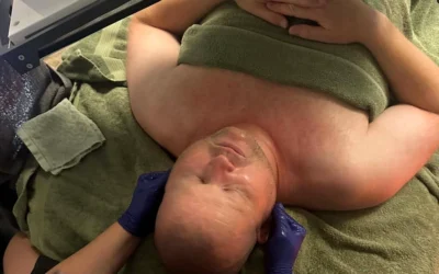 Buccal massage mod kæbespændinger
